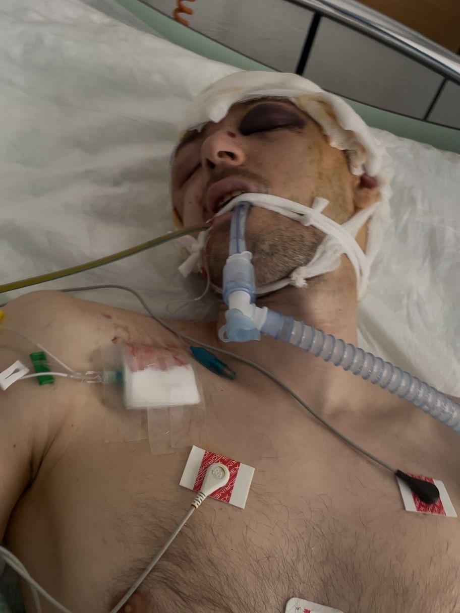 Фото госпитализированного. Источник - Фейсбук