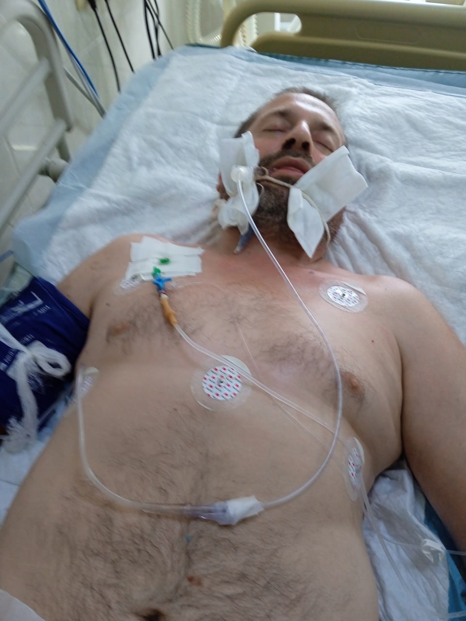 Фото госпіталізованого після мобілізації